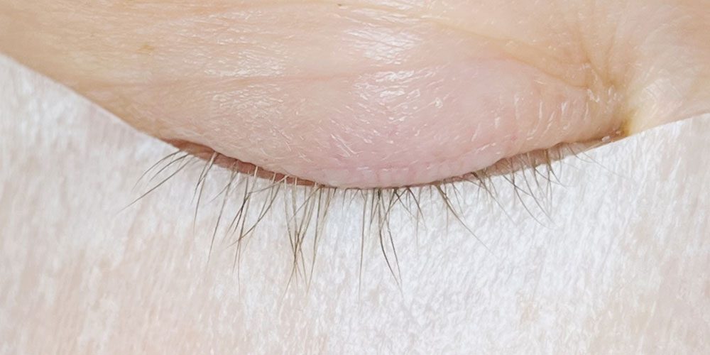 SPC-wimpernserum-testimonials-7-before