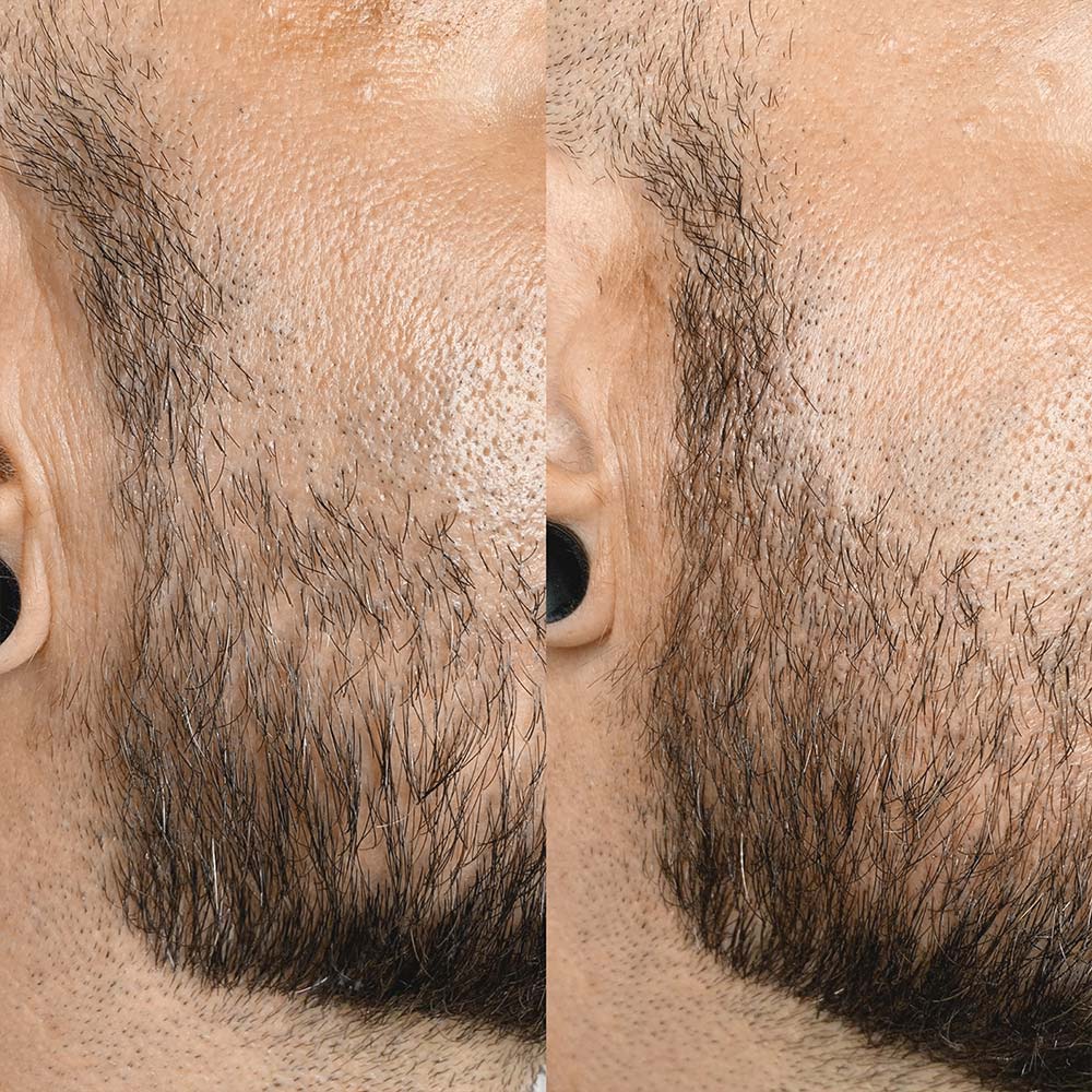 Bart Permanent Make-up Männer