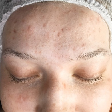 sarapavocosmetics-essen-energylight-ergebnis-3vorher